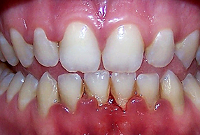 odontologia Iwai